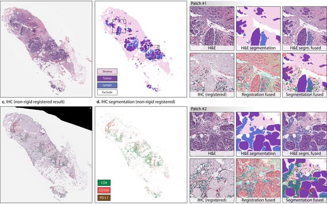 Brain Proteomic Analysis